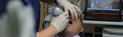 Root Canal Costs and Financing Options